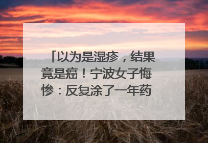 以为是湿疹，结果竟是癌！宁波女子悔惨：反复涂了一年药膏都没好！很多患者首诊都去了皮肤科